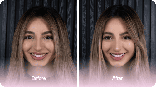 Dental Implants - Before and After